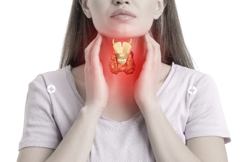 thyroid gland,Ayurveda Conventional medicine Thyroid health Thyroid disorders Doshas, Integrative medicine, Individualized treatment, Lifestyle changes, Herbal remedies, Stress management,